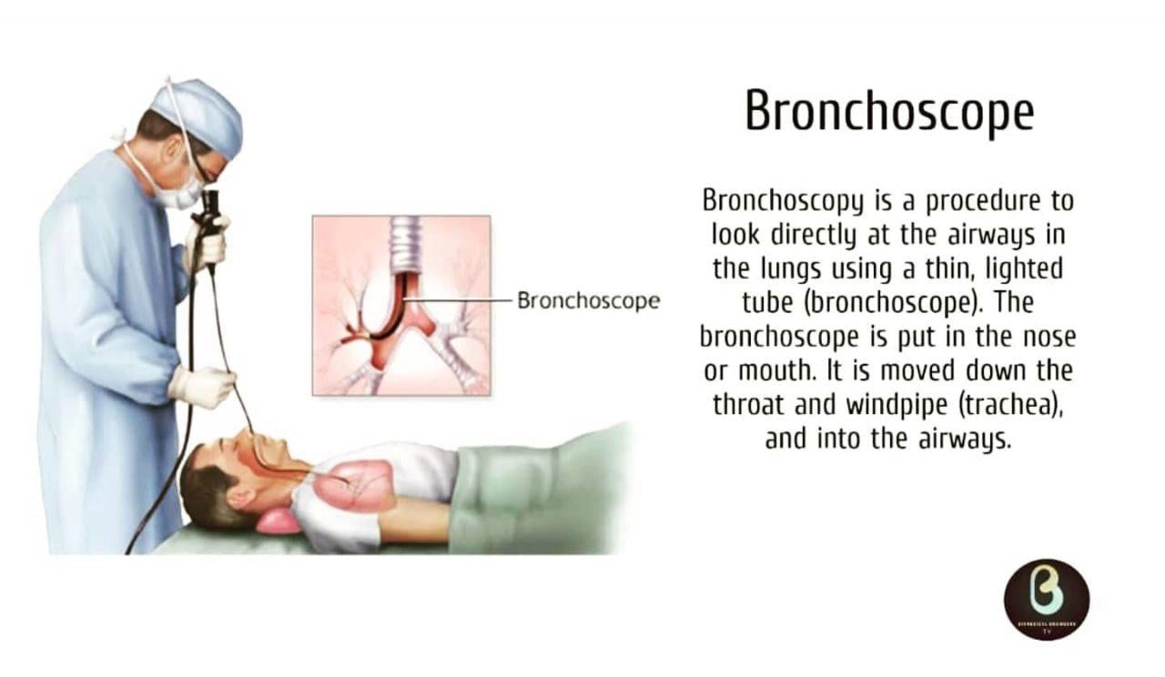 [SOLVED] Write a detailed note on Bronchoscope Bronchoscope ...