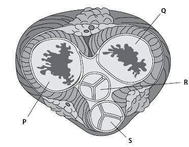 [SOLVED] The diagram below shows a cross-section of the heart at the (1 ...